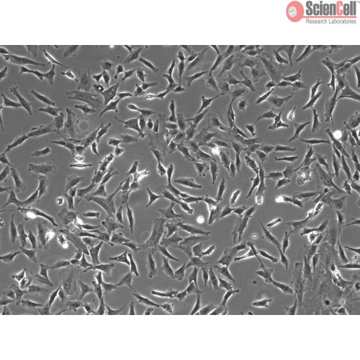Human Astrocyte Cell_HRA